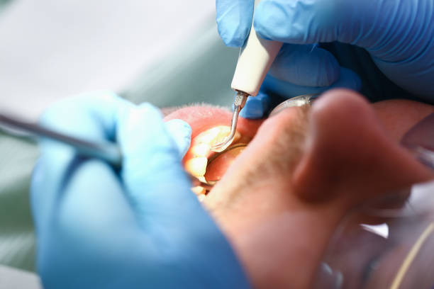 Best Emergency Denture Repair in Sunray, TX